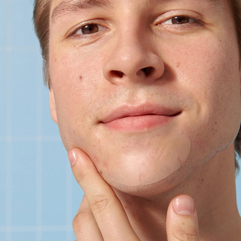 chin-acne-patch-hydrocolloid (5)