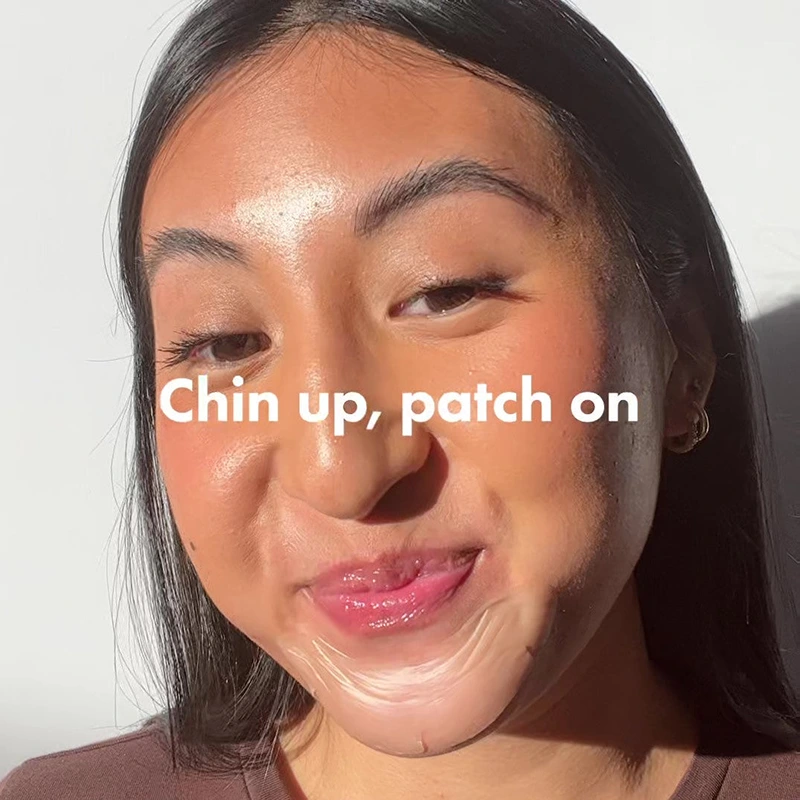 chin-acne-patch-hydrocolloid (7)