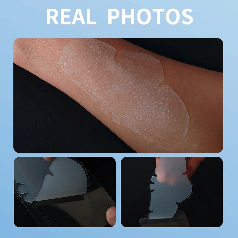 hydrocolloid nose patch (3)