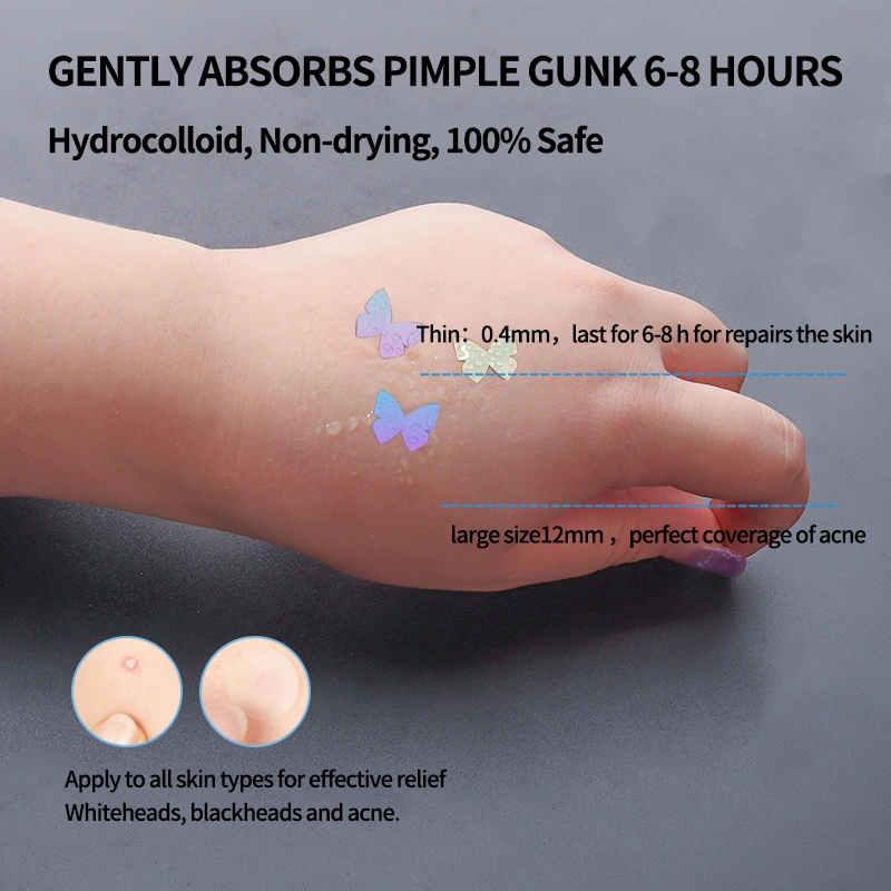 holographic-acne-patches-laser-gradient (7)