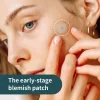 hydrocolloid-micropoint patch early stage blemishes (6)