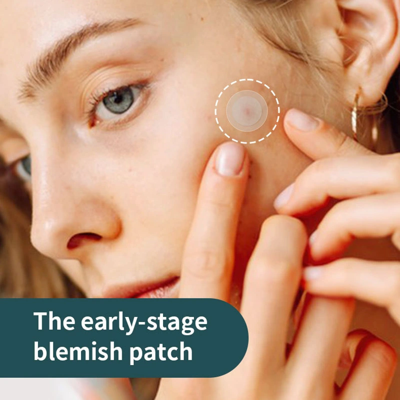 hydrocolloid-micropoint-patch-early-stage-blemishes (6) hydrocolloid-micropoint patch early stage blemishes (6)