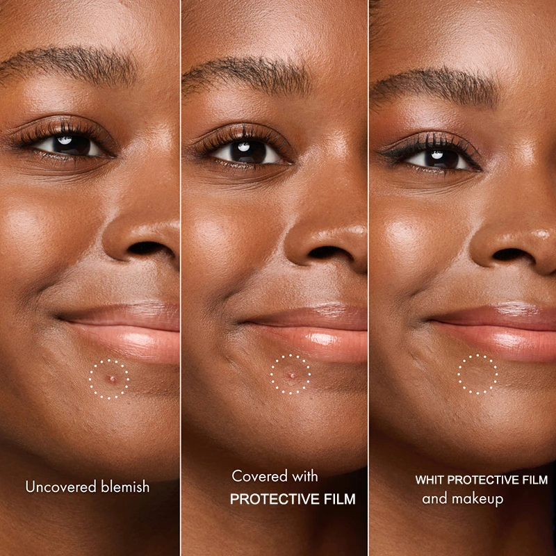 invisible liquid pimple patch (5)