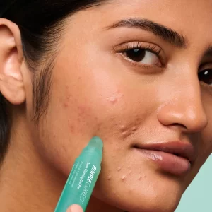 salicylic acid acne pen (4)