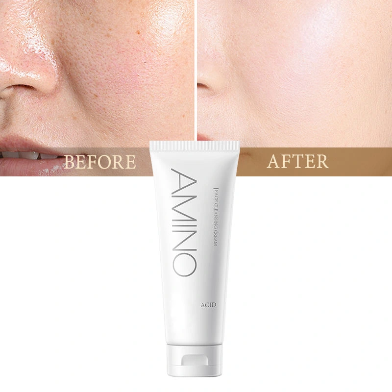Advanced Amino Acid Skin-Repairing Facial Cleanser – 100g Gentle Pore Purifier - Image 4