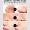 bamboo charcoal blackhead nose strips vegan (6)
