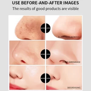 bamboo charcoal blackhead nose strips vegan (6)