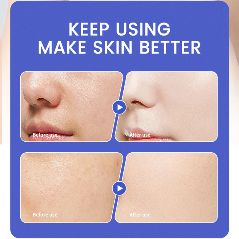 Korean-Style Niacinamide & Alpha-Arbutin Brightening Facial Cleanser – 120ml Deep Pore Purifier - Image 2