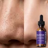 salicylic acid bha blackhead liquid serum oem Yquida (4)
