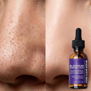 salicylic acid bha blackhead liquid serum oem Yquida (4)
