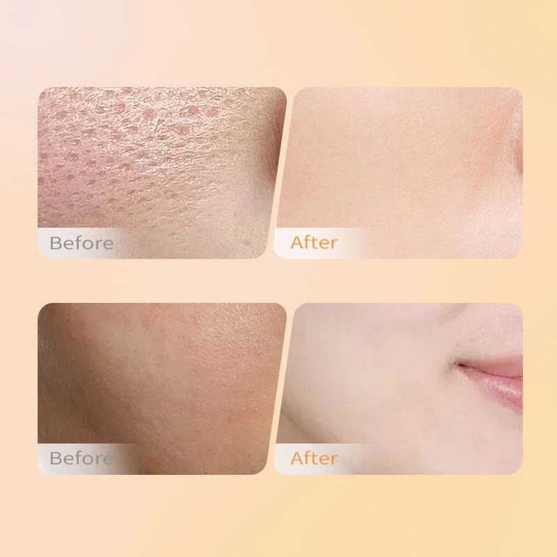 Vitamin C & Amino Acid Brightening Facial Cleanser – 150g Advanced Glow Wash - Image 5