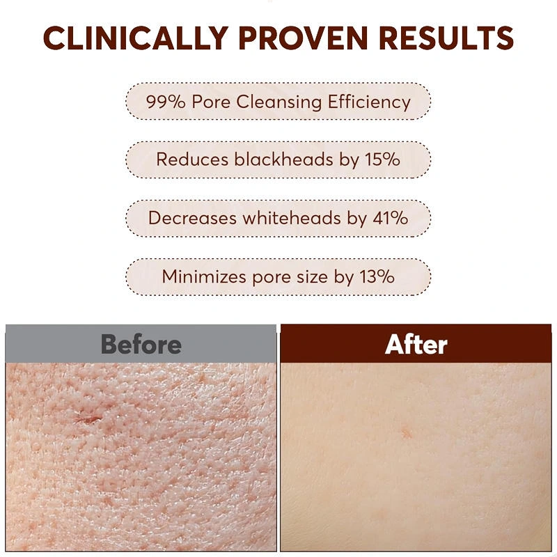 Botanical Berry & Herbal Tea Pore-Refining Cleansing Balm – Ultimate Makeup Remover - Image 3