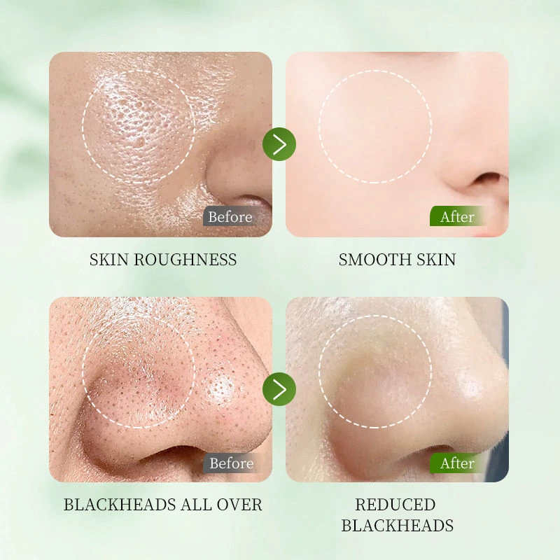 Fruit Enzyme & Niacinamide Instant Brightening Peeling Gel – 50g Gentle Dead Skin Remover - Image 2
