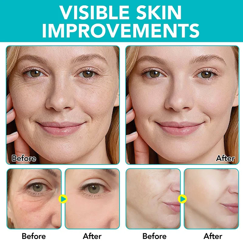 Micro-Needle Undereye Masks: Advanced Eye Care Solution - Image 5